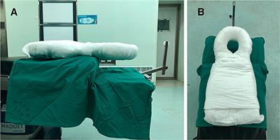 An Innovative Prone Position Using a Body-Shape Plaster Bed and Skull Traction for Posterior Cervical Spine Fracture Surgeries